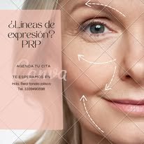 Tratamiento advanced para líneas de expresión con Plasma Rico en Plaquetas (PRP)