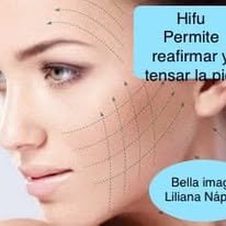 Tratamiento Hifu para reafirmar y tensar la piel del rostro