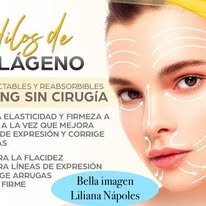 Aplicación de hilos de colágeno inyectables para lifting sin cirugía