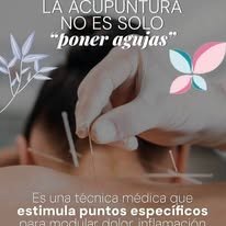 Sesión de acupuntura médica tradicional para modular el dolor y la inflamación estimulando puntos específicos