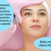 Publicación sobre tratamiento de mesoterapia facial