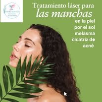 Anuncio de tratamiento de yesoterapia corporal