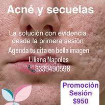 Anuncio de paquete de tratamientos faciales y corporales